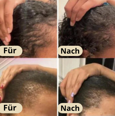 Veganic - Natürliches Haarwuchsöl